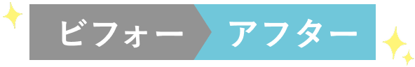 before-after