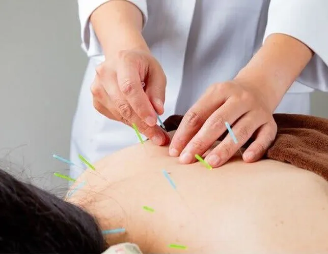 鍼灸施術